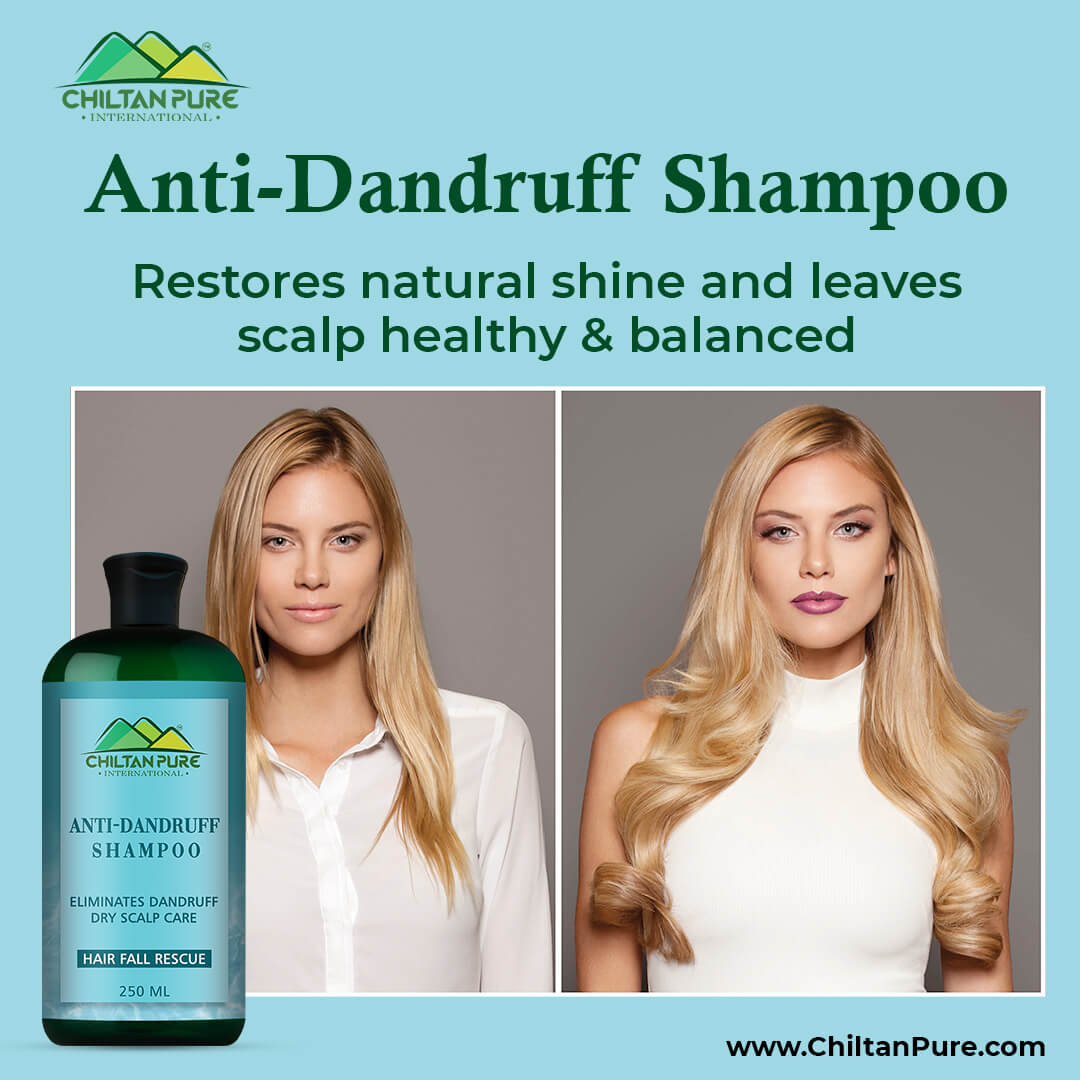 Anti Dandruff Shampoo Price in Pakistan - Buy Dandruff Treatment at ...