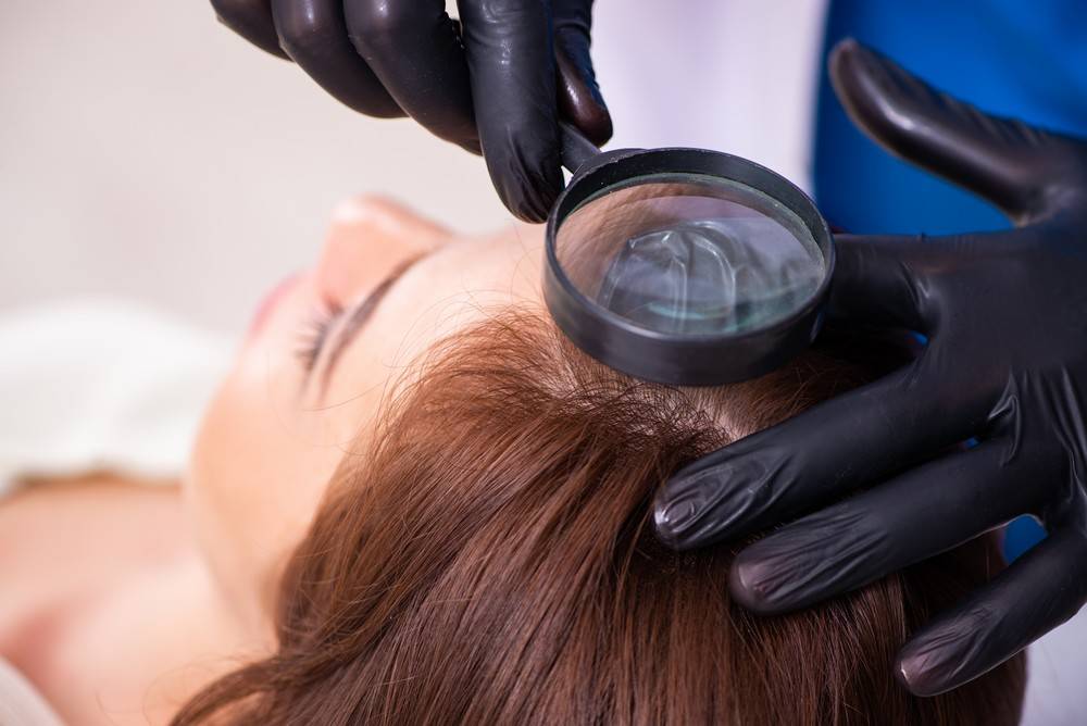 Comment agissent les traitements pour cheveux spécifiques sur les irritations du cuir chevelu ?-2