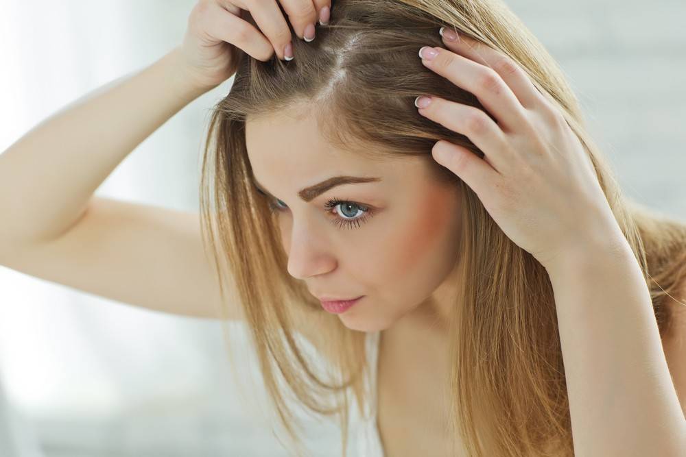 Comment choisir un traitement pour cheveux adapté à son type de cuir chevelu ?-1