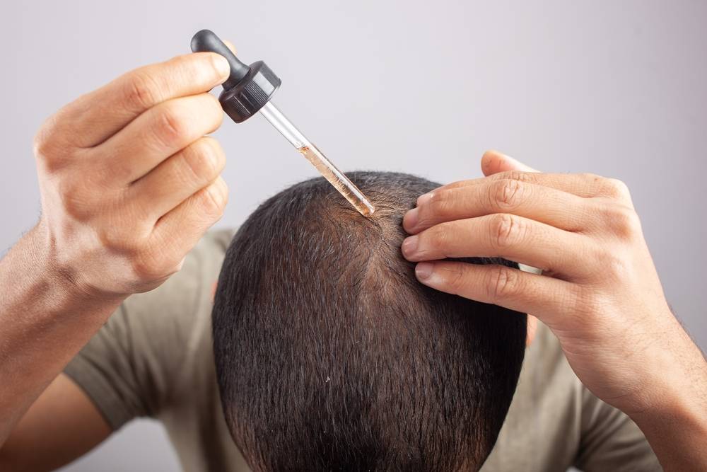 Comment réduire les risques d'une irritation du cuir chevelu ?-2