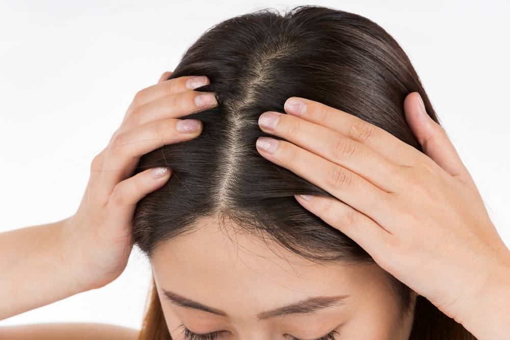 Tout savoir sur le psoriasis du cuir chevelu et le traitement des cheveux-2
