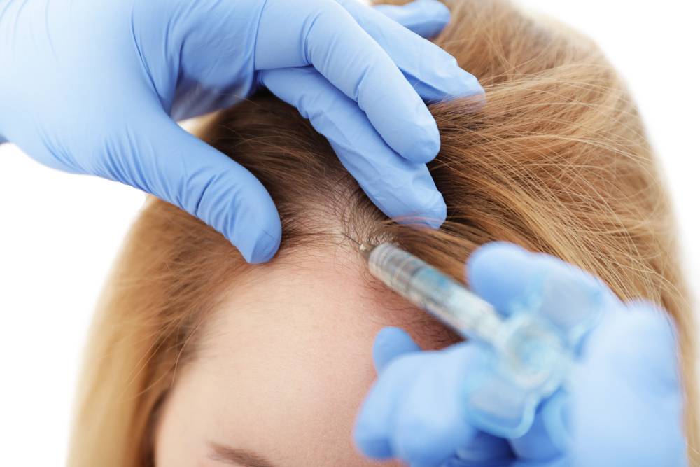 Traitement pour cheveux et affections médicales : l'impact sur le cuir chevelu-1