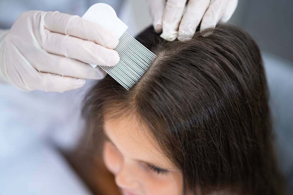 Traitement pour cheveux contre les irritations du cuir chevelu : sont-ils adaptés à tous les types de cheveux ?-2
