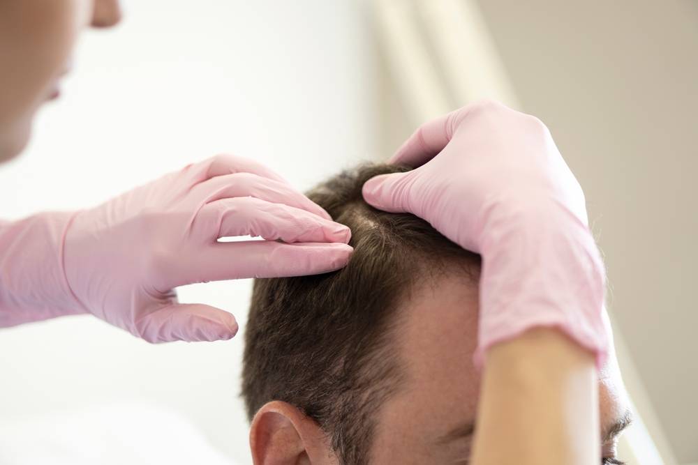 Traitement pour cheveux : quels sont les facteurs externes affectant la santé du cuir chevelu ?-2