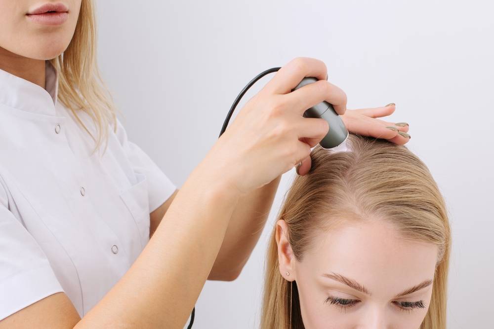Traitement pour cheveux : quels sont les signes d'une mauvaise santé du cuir chevelu ?-2