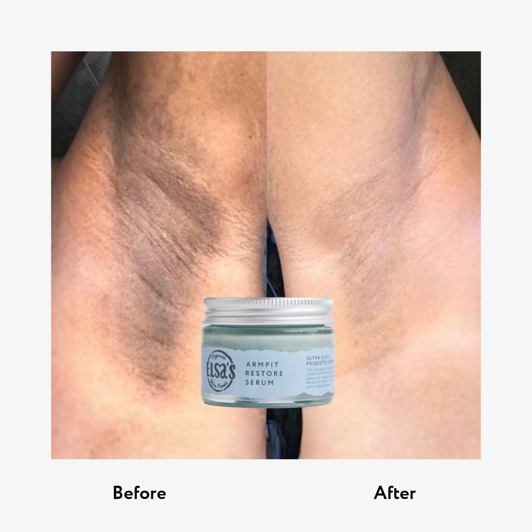 Elsas Organic Skinfoods Armpit Restore Serum Before and After Shot