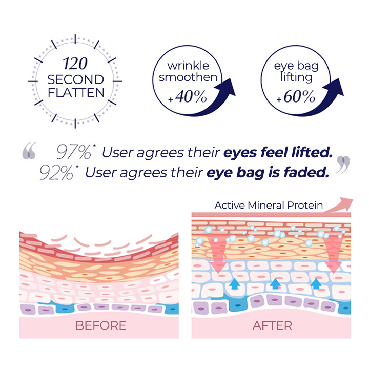 SOS™ Instant Eye Bag Cream – Herbaluxy