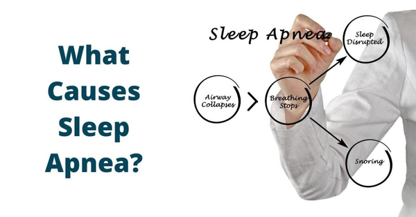 sleep apnea