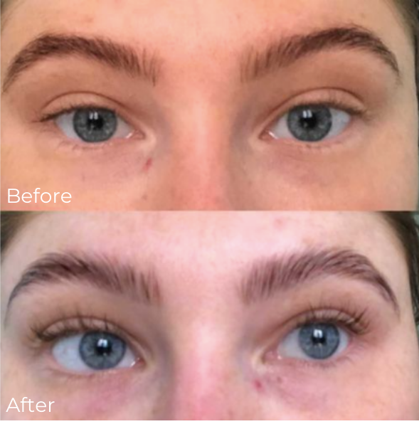 Brow lamination before and after