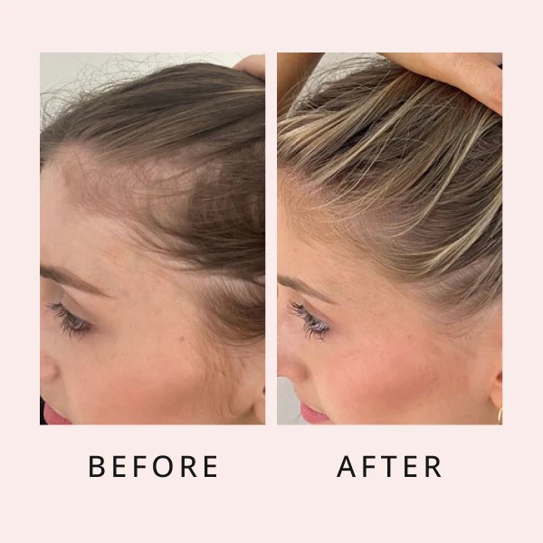 hair growth serum before and after result 1