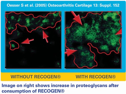 how recogen works singapore health collagen supplement for joint
