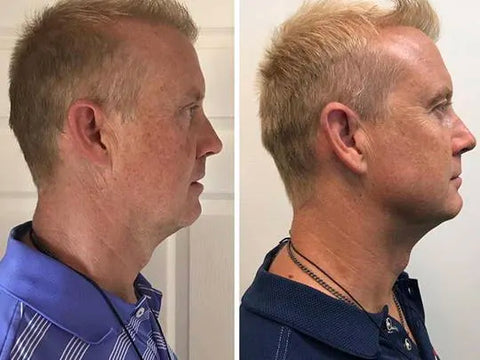 EXERCITADOR DE MANDÍBULA - JAWLINE PRO™ –  - Loja de produtos  de cuidados pessoais, exercícios e utilidades para sua casa.