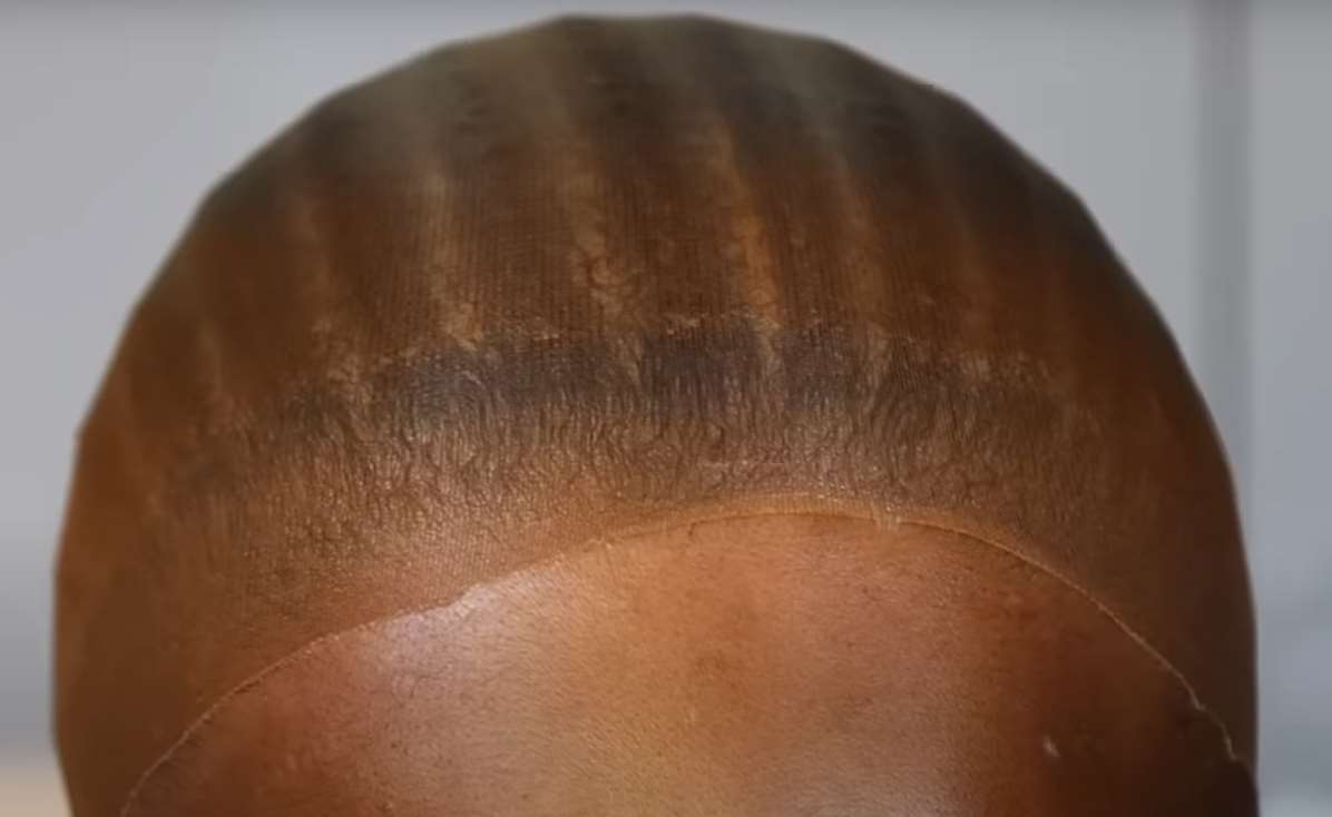 bald cap method