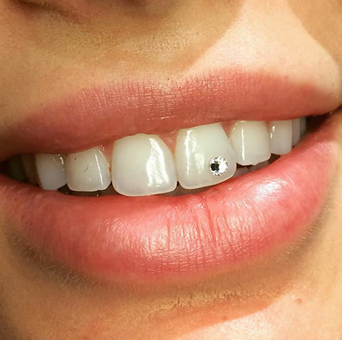 What You Should Know Before Getting Tooth Gems