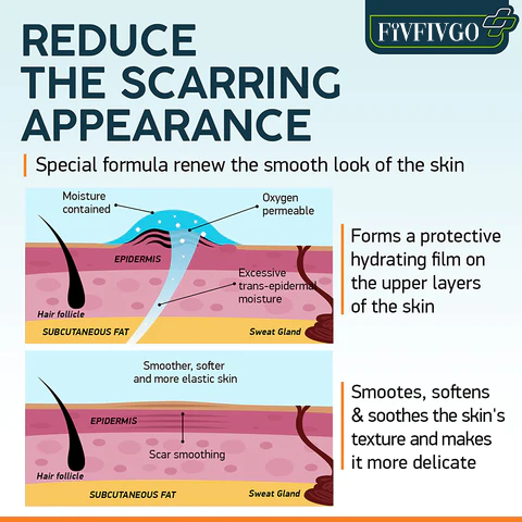 Fivfivgo™ ScarRemove Advanced Scar Spray