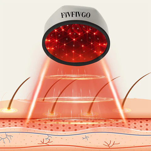 Fivfivgo™ Mobile Lasertherapie-Kappe für Haarwuchs