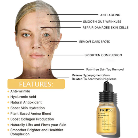 Fivfivgo™ Blemish Treatment Serum for Dark Spots & Acanthosis Nigricans & Skin Tag