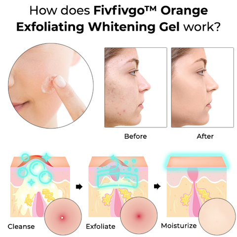 Fivfivgo™ Orange Peeling-Aufhellungsgel