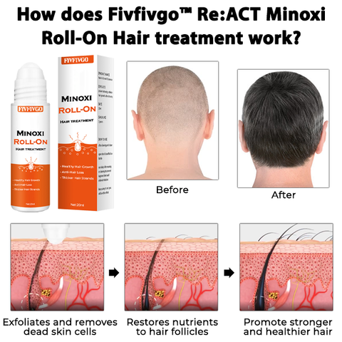 Fivfivgo™ Re:ACT Minoxi Roll-On Hair Treatment