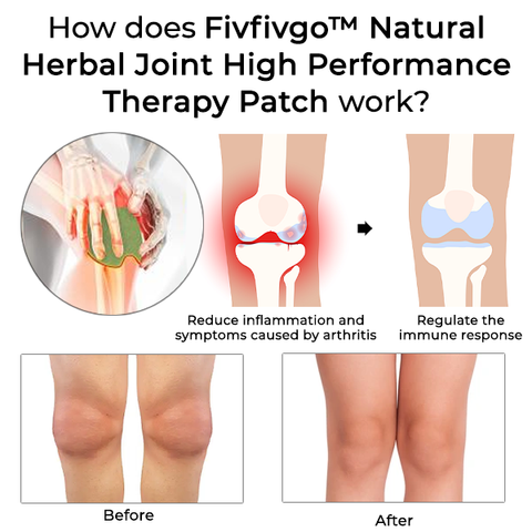 Fivfivgo™ Natürliches Kräuter-Gelenk-Hochleistungstherapie-Pflaster 