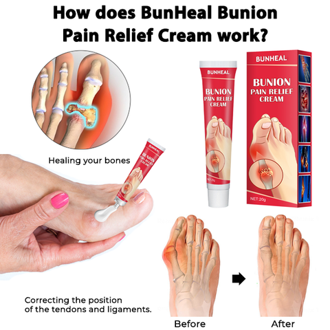 BunHeal Bunion Pain Relief Cream 