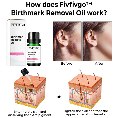 Oveallgo™ Birthmark Removal Oil