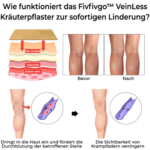 Fivfivgo™ VeinLess Kräuterpflaster mit sofortiger Linderung