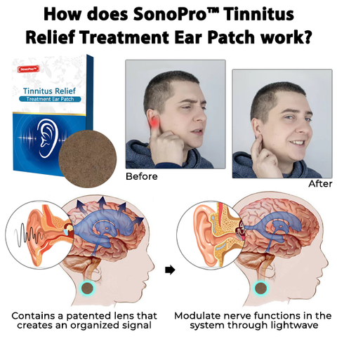 GERMAN SonoPro™ Tinnitus Relief Treatment Ear Patch