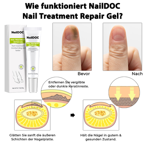 NailDOC Nagelbehandlung Repair Gel