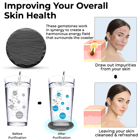 Oveallgo™ ProX IONWater Skin Detoxing Energy Gemstone Coaster