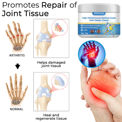 Fivfivgo™ Hochleistungs-Gelenkreparaturcreme in medizinischer Qualität