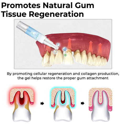 Oveallgo™ Gum Shield Therapy Gel