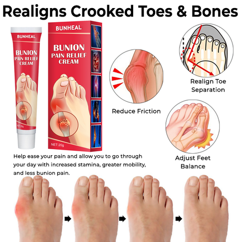 BunHeal Bunion Pain Relief Cream 