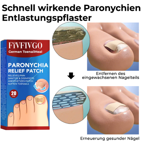 Fivfivgo™ German ToenailHeal Paronychie-Linderungspflaster