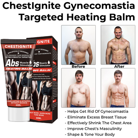 ChestIgnitePLUS Gynecomastia Targeted Heating Balm