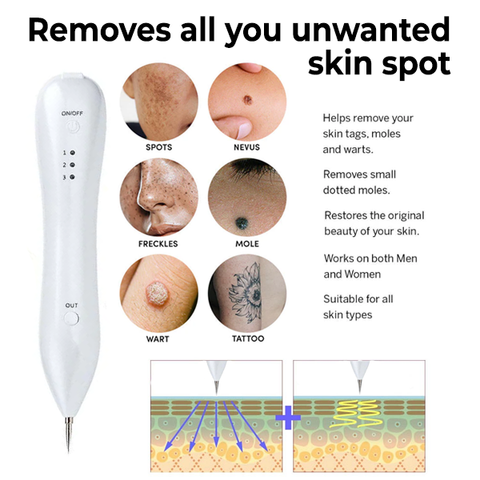 Spot Removal Electric Beauty Pen
