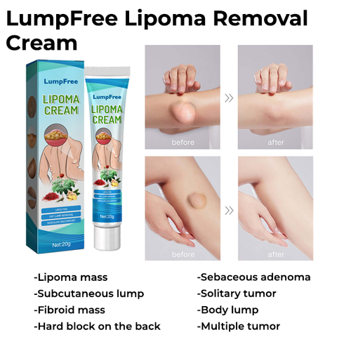 LumpFree™ Lipoma Removal Cream 