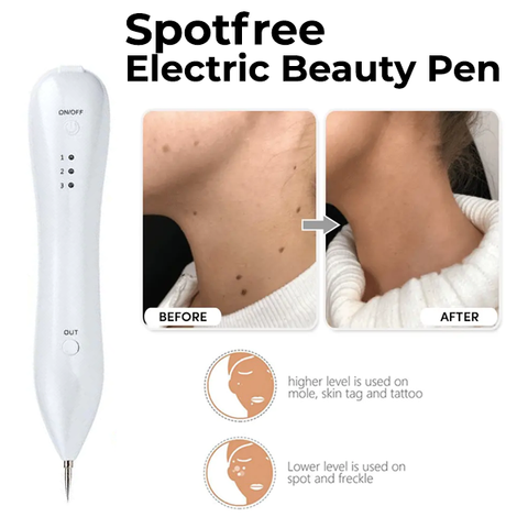 Spot Removal Electric Beauty Pen
