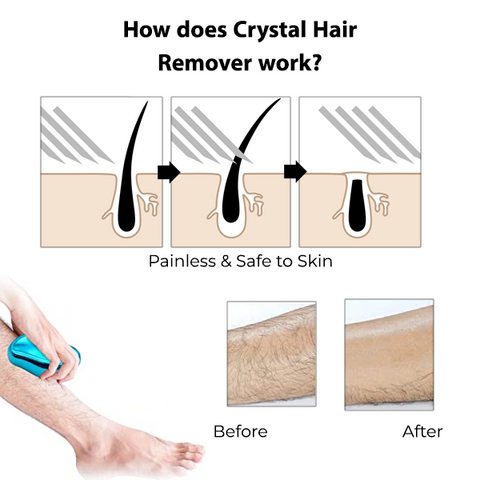 Crystal Hair Remover