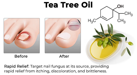 Oveallgo™ FungiGuard Nail Rescue Spray
