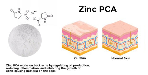 CC™ ToxiKlenz Back Acne Treatment Spray