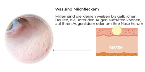 Fivfivgo™ Milk Spots Therapy Elektrischer Serumstift