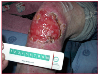 Figure 1. Prior to treatment being commenced