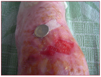 Figure 3. After 6 weeks of treatment
