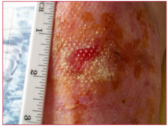 Figure 4a. After 9 weeks of treatment