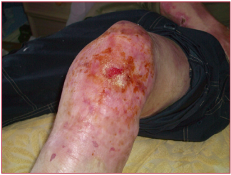 Figure 4b. After 9 weeks of treatment