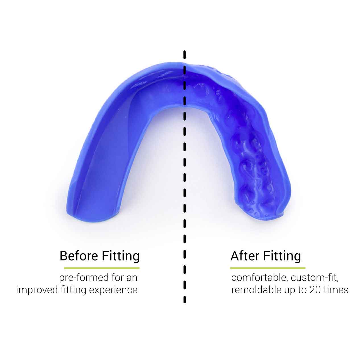 SISU 3D Custom Fit Mouthguard