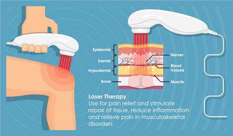 Laser Therapy is used for pain relief and stimulates tissue repair, reduces inflammation and relieves pain in musculoskeletal disorders.