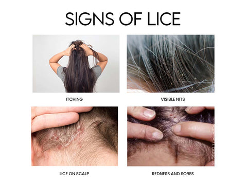 Collage showing common signs of lice infestation: itching, visible nits, lice on scalp, and redness with sores