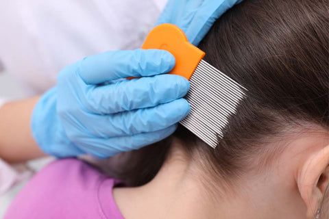 A close-up photo of someone wearing blue gloves using a fine-toothed lice comb on a person's hair to remove lice or nits, indicating a lice treatment process.